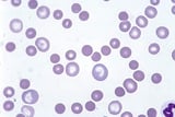 White Blood Cells: