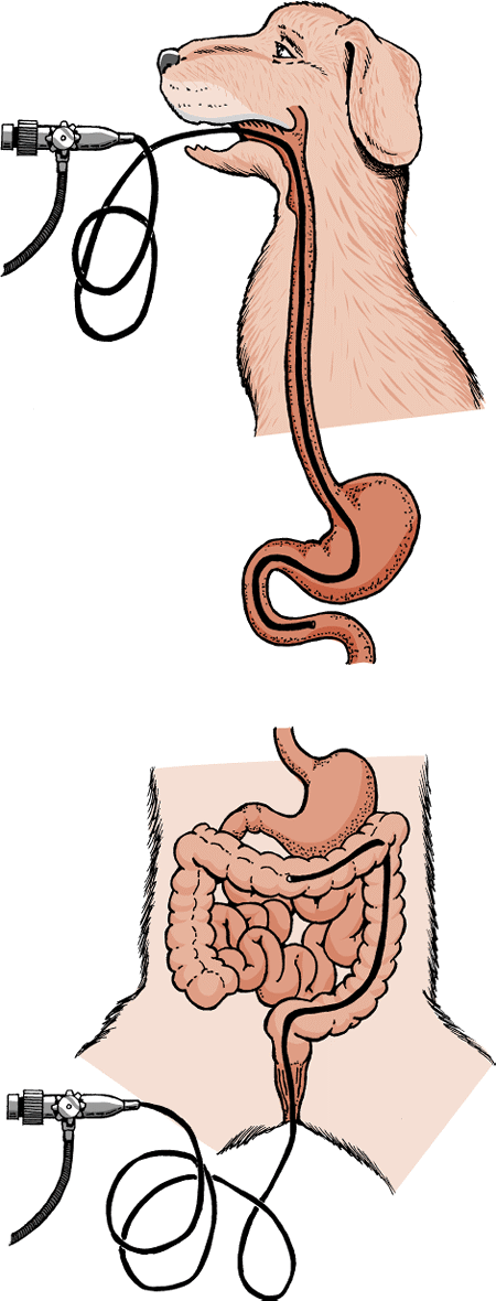 Examination of the digestive tract with an endoscope.