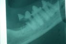 Tooth Resorption in Small Animals