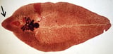 <i >Fasciola hepatica</i> in Ruminants