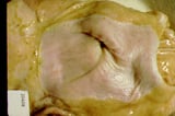 Gastric Ulcers in Pigs
