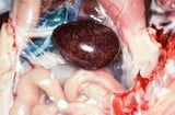 Hemorrhagic Enteritis / Marble Spleen Diseasein Poultry