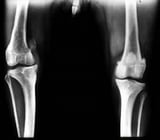 Patellar Luxation in Dogs and Cats