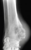 Bone Tumors in Dogs and Cats