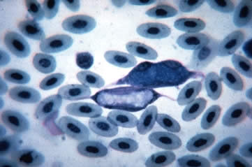 Leucocytozoon,