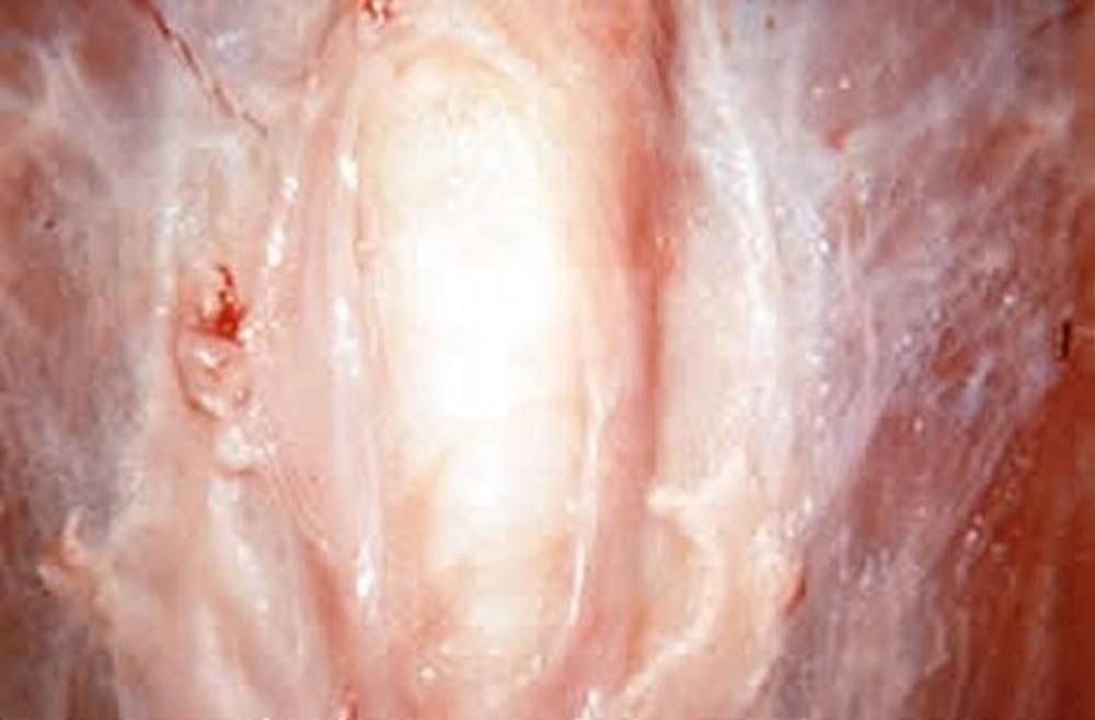 Breast Blisters in Poultry - Poultry - Merck Veterinary Manual