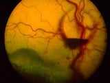 Ophthalmic Manifestations of Systemic Diseases in Animals