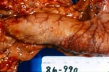 Cholecalciferol (Vitamin D<sub >3</sub>) Poisoning in Animals