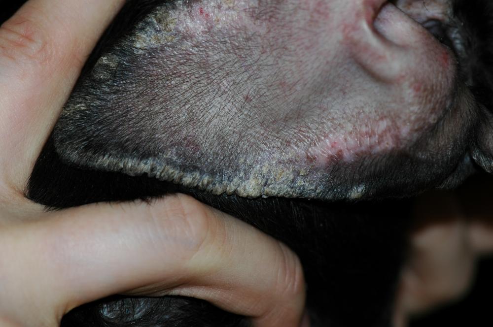 Seborrhea in Dogs - Dog Owners - Merck Veterinary Manual