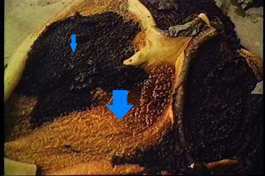 Rumen necrosis and hemorrhage, bovine